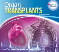Organ_Transplants