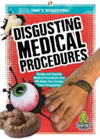 Disgusting_Medical_Procedures